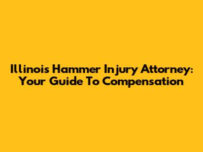 Illinois Hammer Injury Attorney: Your Guide To Compensation