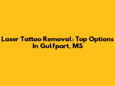 Laser Tattoo Removal: Top Options In Gulfport, MS